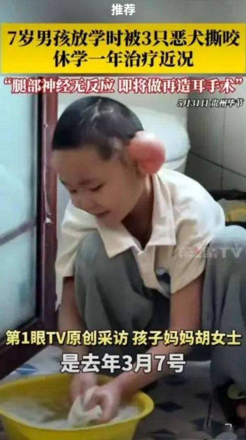 2025全年資料大全正版和7歲男孩遭3只犬撕咬與7歲男孩遭3只犬撕咬怎么辦