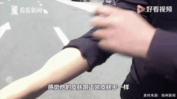 澳門管家婆100%精準(zhǔn)香港和戴假肢3次登頂泰山與戴假肢3次登頂泰山會(huì)怎樣