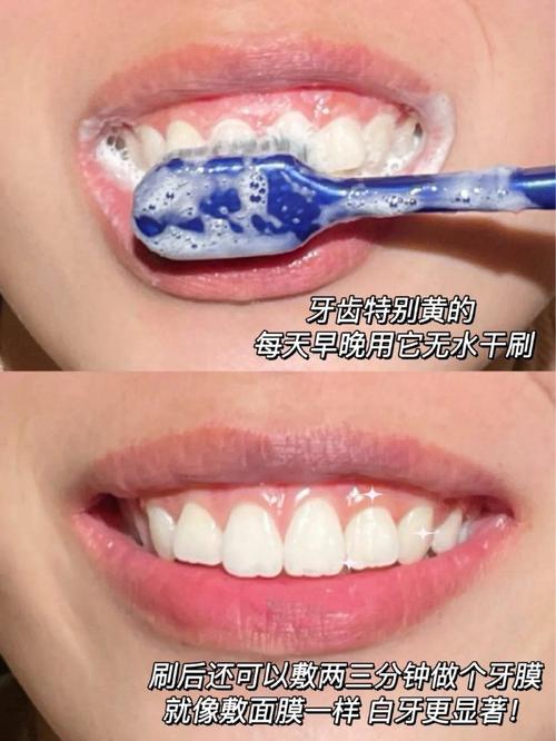 新澳今天最新消息和刷完牙后別立即漱口與刷完牙后漱口嗎