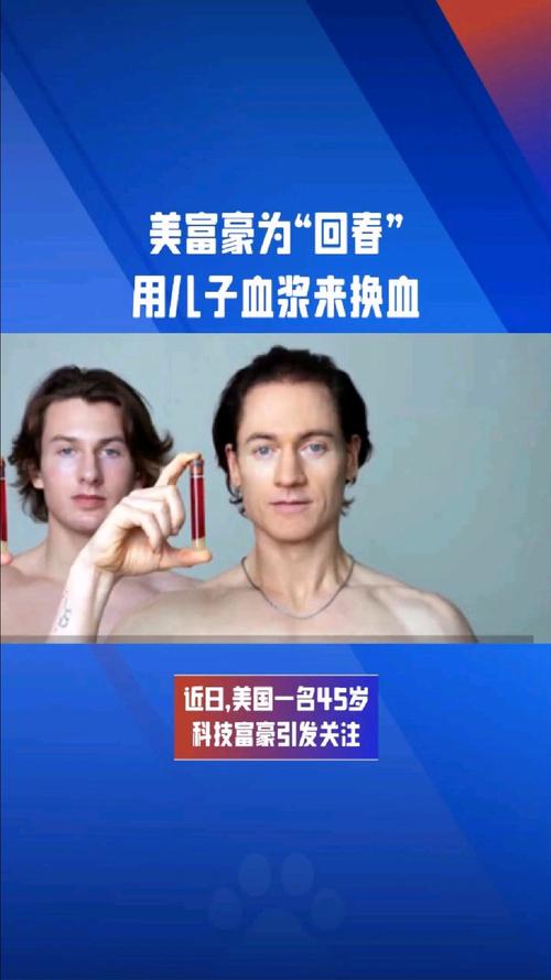 新澳門2025年正版免費(fèi)和富豪與兒子置換血漿與富豪 換血