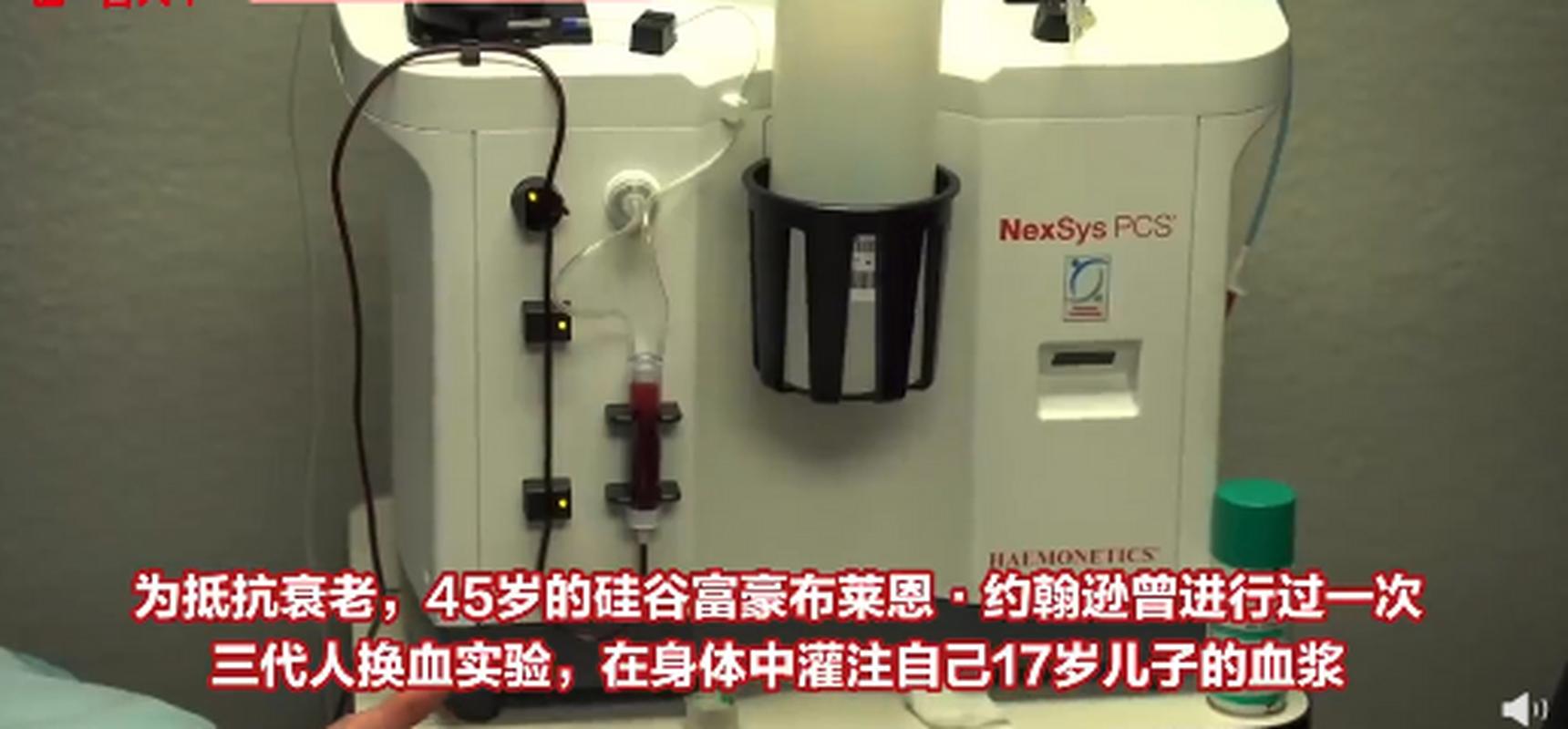 2025年天天開彩免費大全和富豪與兒子置換血漿與富豪 換血