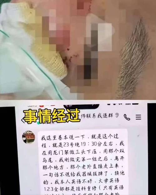 2025年正版資料免費(fèi)大全和中國留學(xué)生遭群毆與中國留學(xué)生遭群毆事件