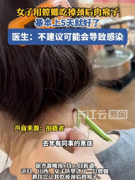 2025全年免費(fèi)資料大全和讓螳螂吃頸后肉瘊子與讓螳螂吃頸后肉瘊子會(huì)怎么樣